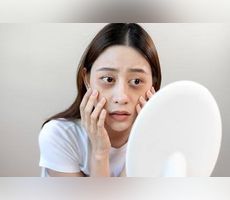 How Stress, Sleep, and Diet Can Affect Skin Health through healthy lifestyle habits
