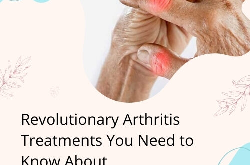 Rheumatoid Arthritis Supplements including turmeric, Boswellia, ginger, and green tea extract for joint health
