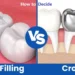 Crown or Filling? How to Know Which Your Tooth Really Needs