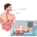 painless endoscopy hospital in guwahati