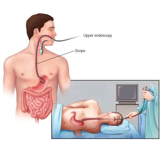 painless endoscopy hospital in guwahati