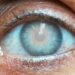 eye test at home in delhi