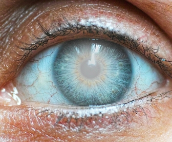 eye test at home in delhi