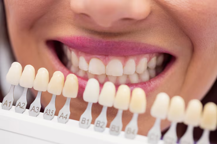 teeth whitening dentist